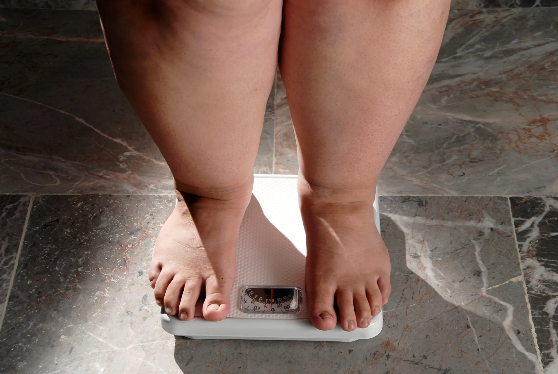 obesity-overweight-woman-feet-on-scale
