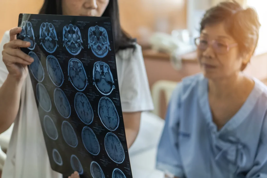 Neurodegenerative Disorders