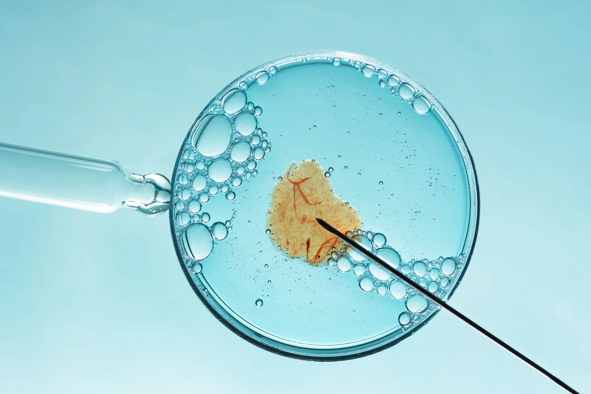 The Role of mt-tsRNAs