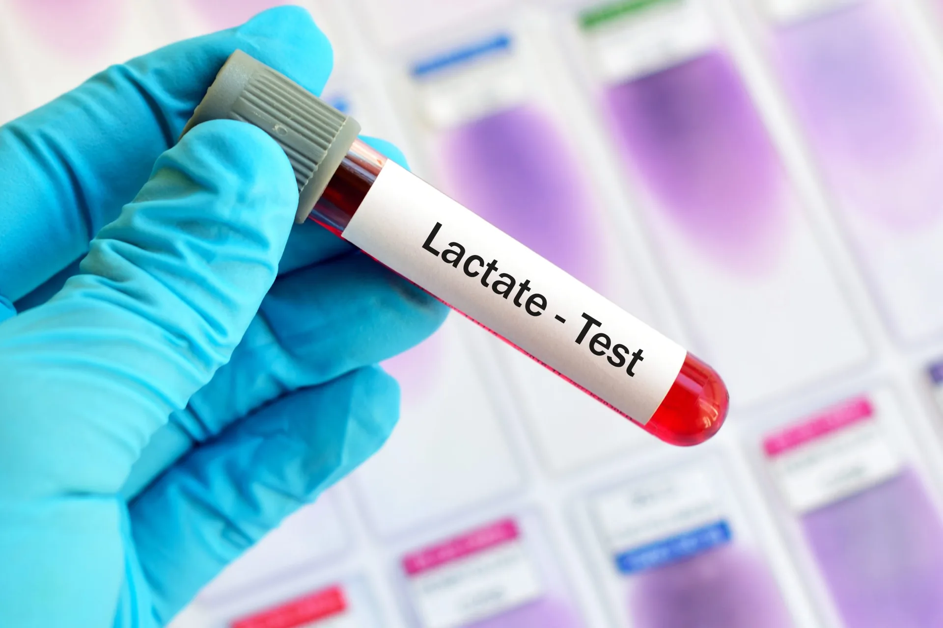 test-tube-blood-sample-lactate