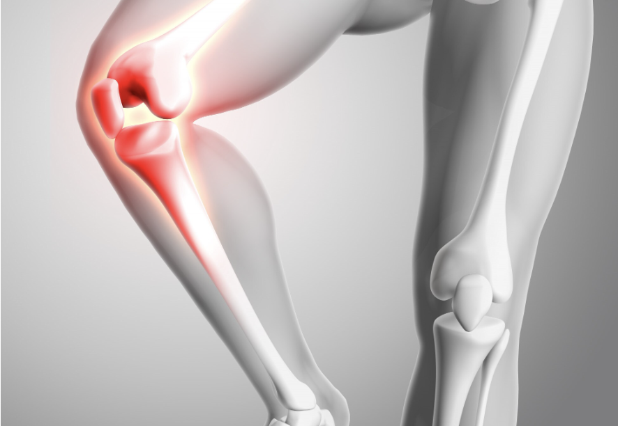 Bone Aches You Can’t Explain